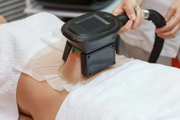 Image of person having fat freezing treatment to help weight gain Witney