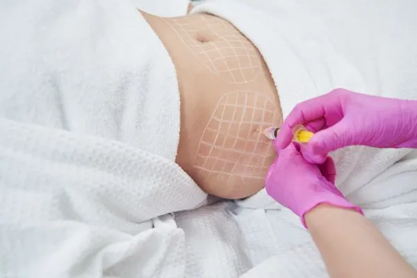 image of fat dissolving injections on love handles to help combat weight gain Witney