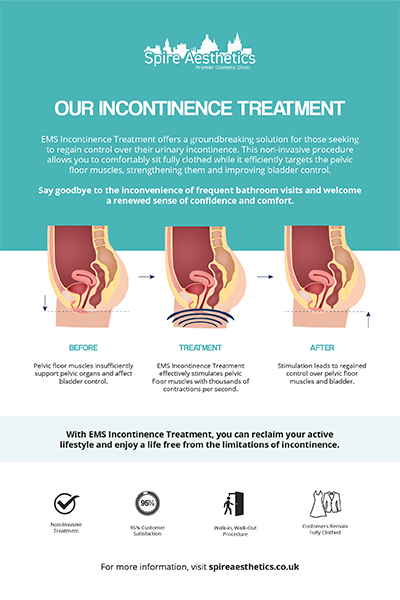 image to show how EMS treatment works for female urinary incontinence Witney