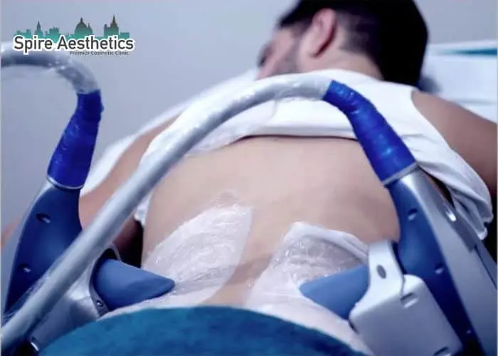 Man having fat freezing treatment done on love handles before a competitions Witney to create a sculpted look.