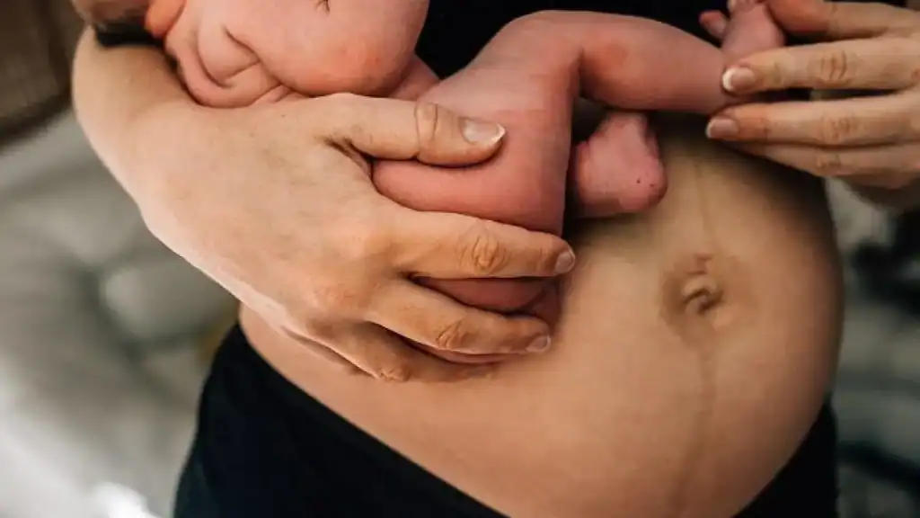 Why Is My Stomach Still Big After Pregnancy Witney?