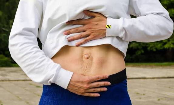 When Could Diastasis Recti Be the Missing Piece of the Puzzle Witney?